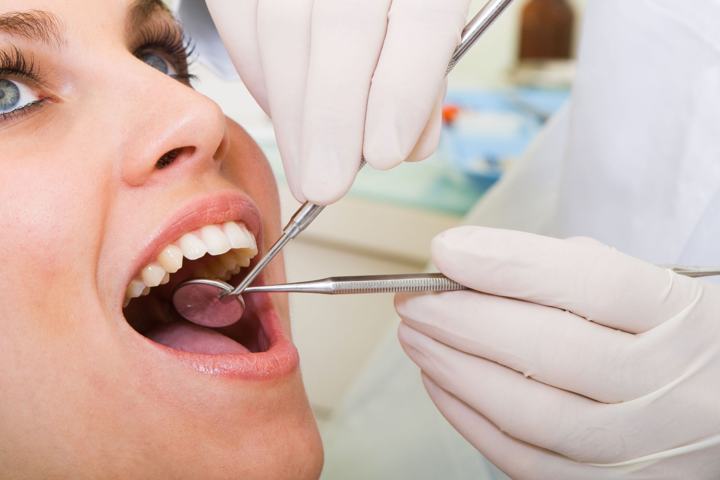 4 Instances Your Cosmetic Dentist in Long Beach, CA, May Recommend Dental Veneers