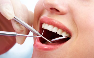 Achieve a Brighter Smile with Professional Teeth Whitening in Madison, WI